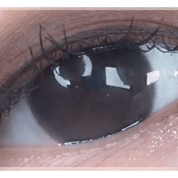 LensTown Konimo2 Black — single-eye close-up showing the contact lens appearance