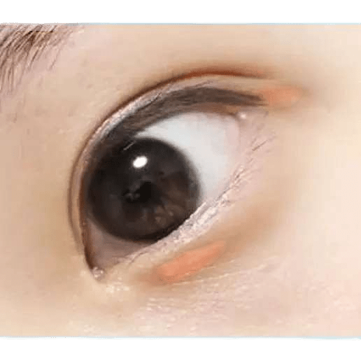 LensTown Nudy Coco Black (10p) — single-eye close-up showing the contact lens appearance