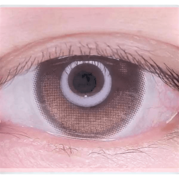 Olens Eyelighter Glowy Brown — single-eye close-up showing the contact lens appearance
