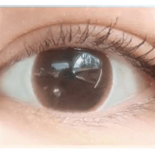Olens From Choco — single-eye close-up showing the contact lens appearance