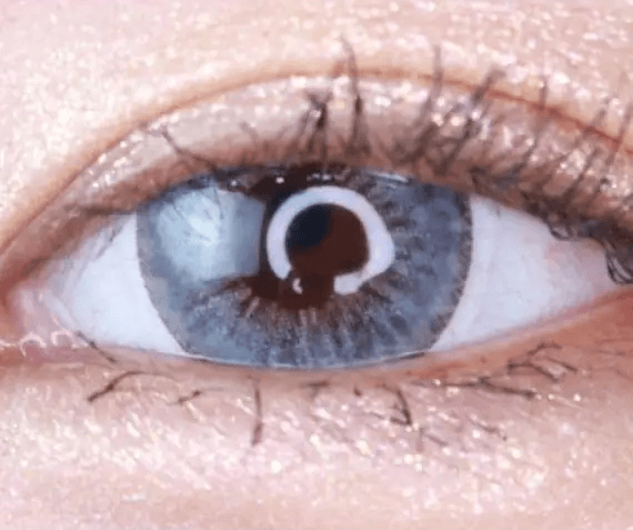 LensTown 247 Fit Gray (10p) — single-eye close-up showing the contact lens appearance