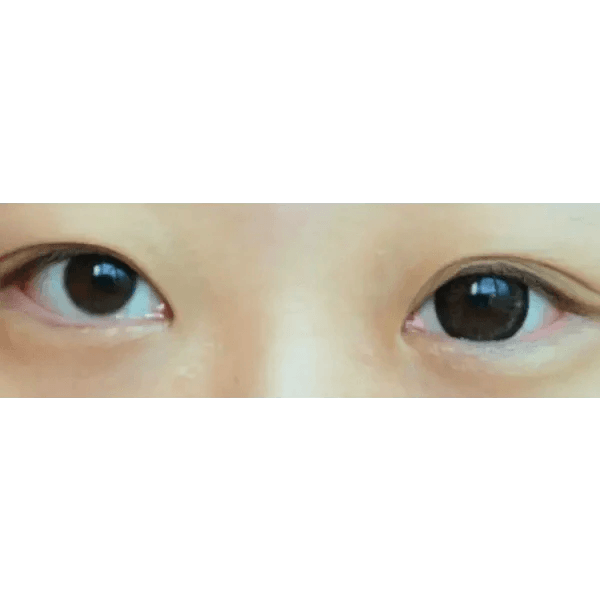 Olens Big Grang Grang Choco — both eyes wearing the contact lenses