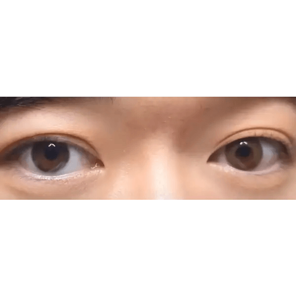 LensTown Breeze 2 Brown — both eyes wearing the contact lenses