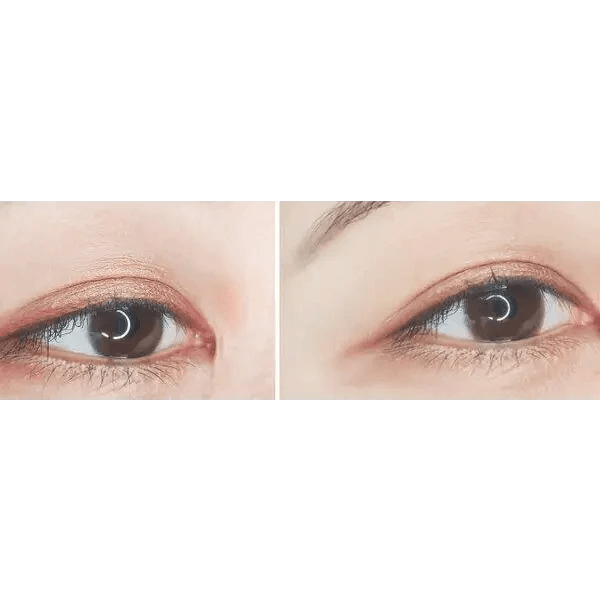 Olens EyeTeen Choco Brown — both eyes wearing the contact lenses