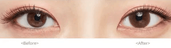 Olens Falling Brown — both eyes wearing the contact lenses