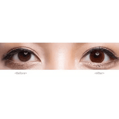 Hidel Magic Gold 13.7mm