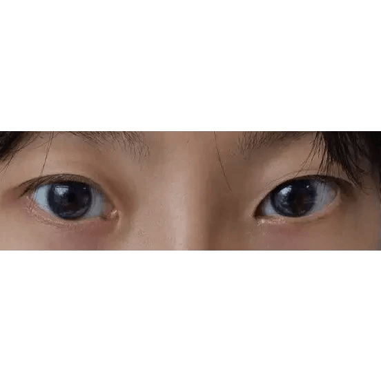 LensRang iWWi Narcissus Blue — both eyes wearing the contact lenses