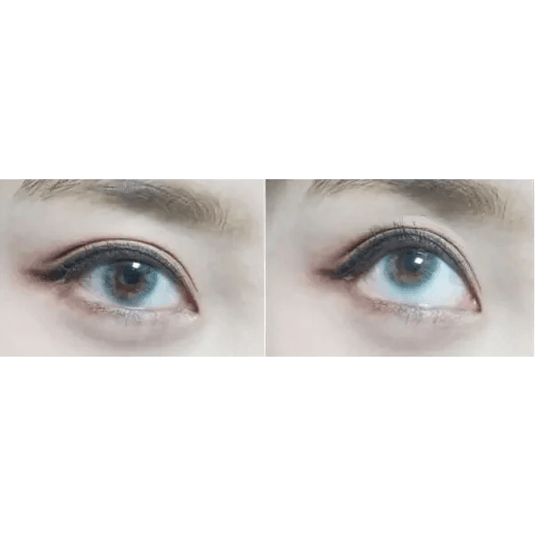 LensTown Kiralet Blue Toric — both eyes wearing the contact lenses