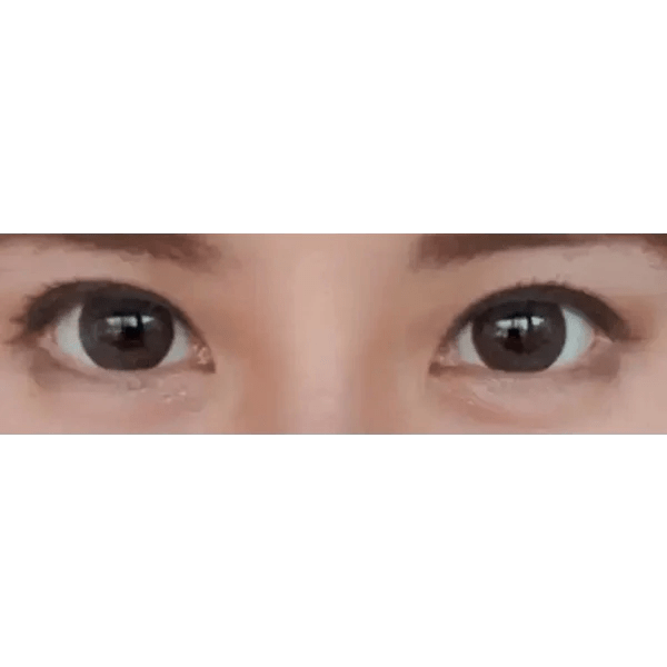 LensTown Silimedi Palm Gray — both eyes wearing the contact lenses