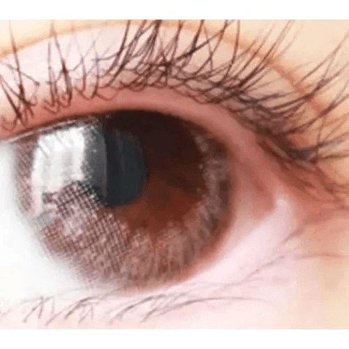 LensTown Lighly Lily Marry Pink (20p) — single-eye close-up showing the contact lens appearance