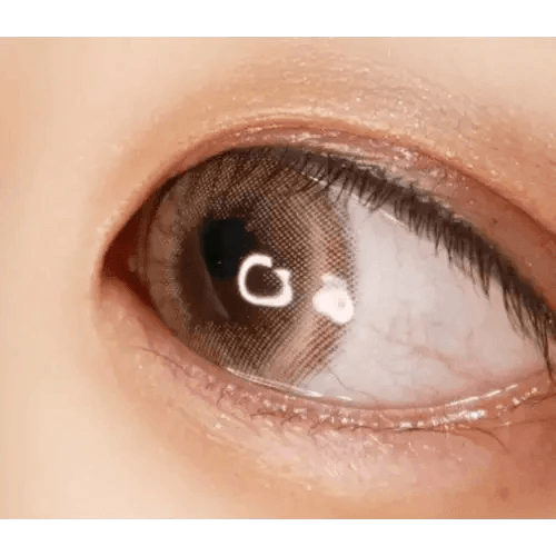 Olens Loving U Brown — single-eye close-up showing the contact lens appearance
