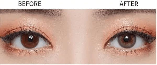 Olens Scandi Gray — contact lens appearance comparison