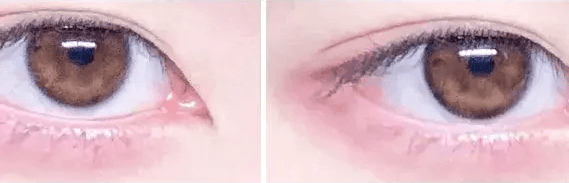 Olens Stay Black — both eyes wearing the contact lenses