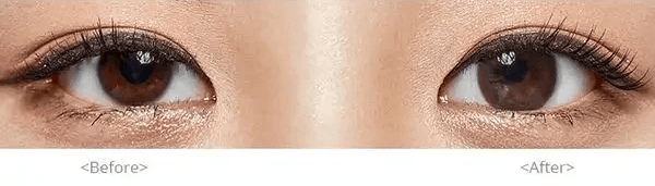 Olens Polla Choco — both eyes wearing the contact lenses