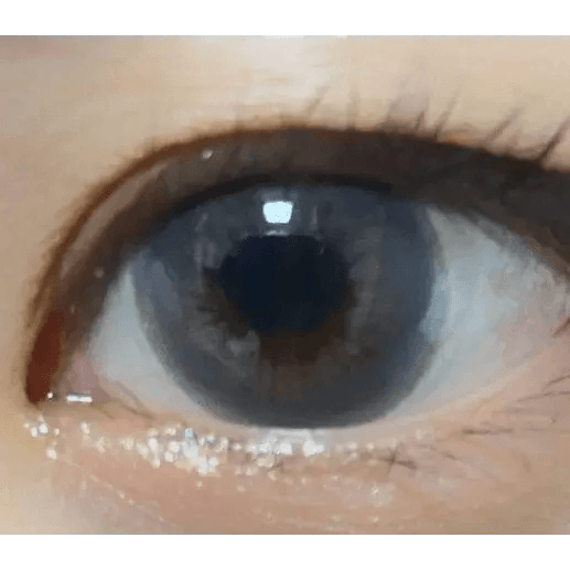 LensVery Rich Ann Mellow Gray (6p) — single-eye close-up showing the contact lens appearance