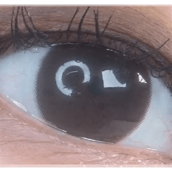 LensTown Konimo2 Choco — single-eye close-up showing the contact lens appearance