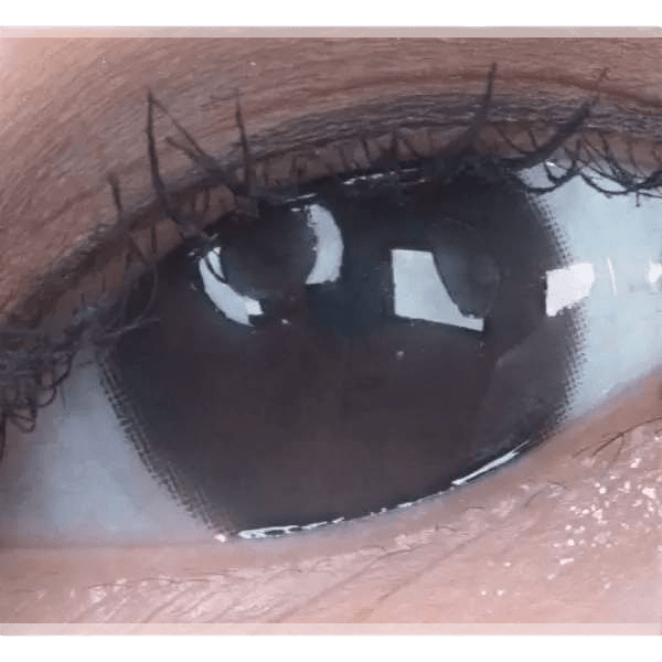LensTown Konimo2 Choco — single-eye close-up showing the contact lens appearance