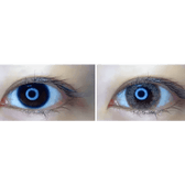 LensTown Lighly Lily Marry Brown (20p) — both eyes wearing the contact lenses