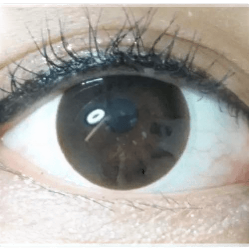 Olens BT Choco Black — single-eye close-up showing the contact lens appearance