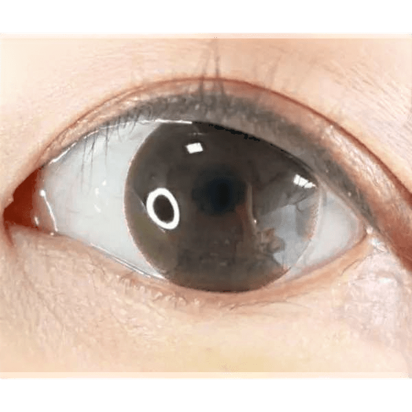 Olens BT Choco Black — single-eye close-up showing the contact lens appearance