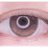 Olens Eyelighter Glowy Brown — single-eye close-up showing the contact lens appearance