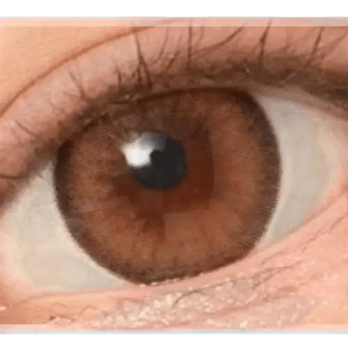 Olens Nils Brown — single-eye close-up showing the contact lens appearance