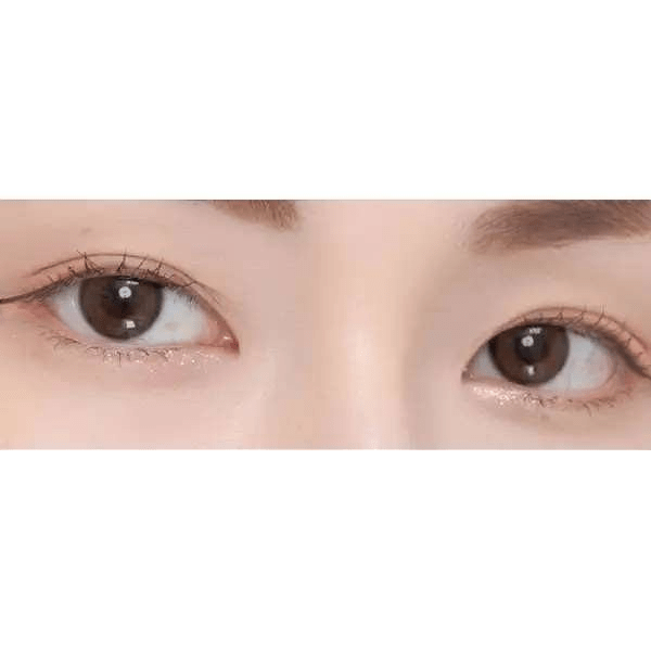 Olens Real Ring Brown — both eyes wearing the contact lenses