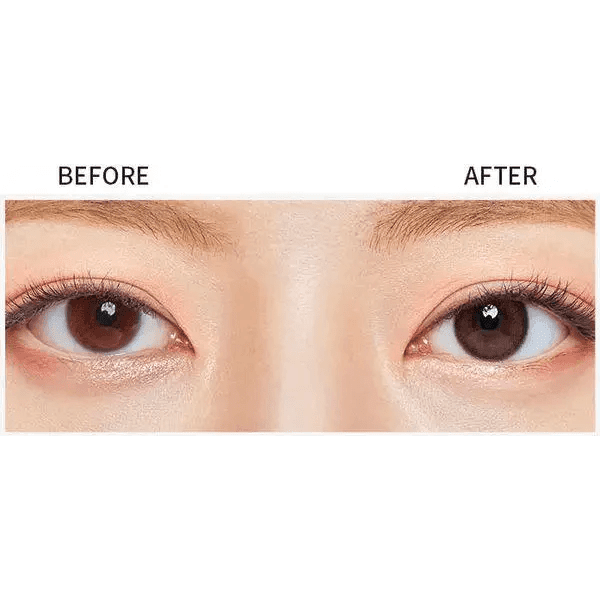 Olens ViVi Ring 1Day Choco (20p) — contact lens appearance comparison