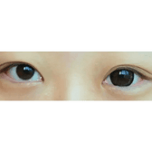 Olens Big Grang Grang Choco — both eyes wearing the contact lenses