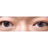 LensTown Breeze 2 Gray — both eyes wearing the contact lenses