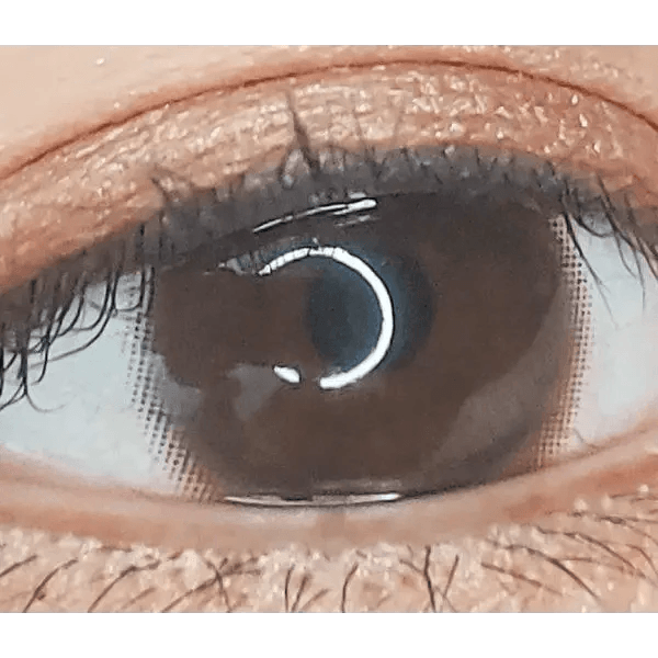 Olens EyeTeen Choco Brown — single-eye close-up showing the contact lens appearance