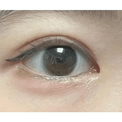 LensRang iWWi Iwwing Black — single-eye close-up showing the contact lens appearance