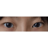 LensRang iWWi Narcissus Blue — both eyes wearing the contact lenses