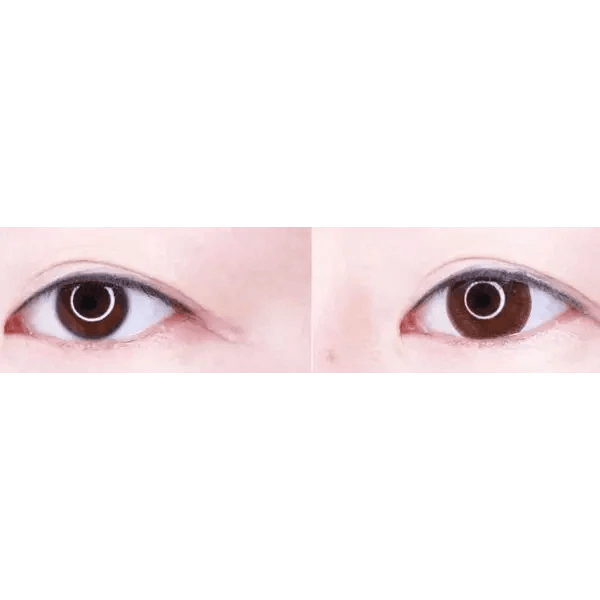LensTown Lighly Classic Brown (20p) — both eyes wearing the contact lenses