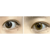 Olens Romantico 3 Color Brown — contact lens appearance comparison